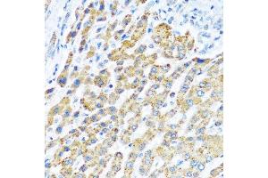 Immunohistochemistry of paraffin-embedded human liver using LRPPRC antibody.