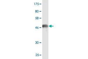 Western Blot detection against Immunogen (47. (HSPB8 antibody  (AA 1-196))