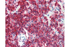 Anti-CD45RA antibody IHC of human spleen. (CD45RA antibody  (FITC))