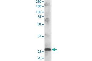 CLPP polyclonal antibody  staining (1 ug/mL) of human muscle lysate (RIPA buffer, 35 ug total protein per lane).