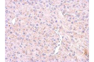 IHC-P Image 5HT1F Receptor antibody [C2C3], C-term detects HTR1F protein at membrane on U87 xenograft by immunohistochemical analysis. (HTR1F antibody  (C-Term))