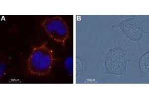 Expression of KCNK18 in ND7/23 cell line - Cell surface detection of KCNK18 in living mouse/rat neuroblastoma x dorsal root ganglion neuron hybrid cell line (ND7/23). (KCNK18 antibody  (1st Extracellular Loop))