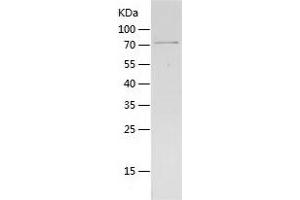 GDI2 Protein (AA 1-445) (His-IF2DI Tag)