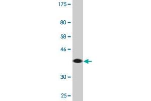 Western Blot detection against Immunogen (37. (RABGAP1L antibody  (AA 1-110))