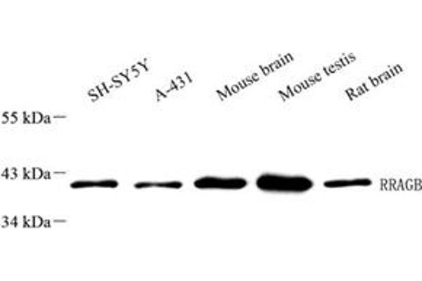 RRAGB antibody