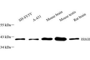 Western blot analysis of RRAGB (ABIN7075379),at dilution of 1: 1000 (RRAGB antibody)