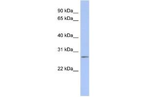 WB Suggested Anti-C14orf166 Antibody Titration:  0. (C14orf166 antibody  (Middle Region))