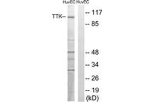Western blot analysis of extracts from HuvEc cells, treated with etoposide 25uM 24H, using TTK (Ab-676) Antibody. (Mps1 antibody  (AA 642-691))