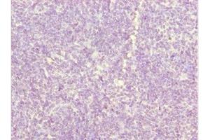 Immunohistochemistry of paraffin-embedded human thymus tissue using ABIN7162540 at dilution of 1:100 (ZDHHC16 antibody  (AA 288-377))