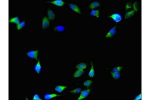 Immunofluorescent analysis of Hela cells using ABIN7148328 at dilution of 1:100 and Alexa Fluor 488-congugated AffiniPure Goat Anti-Rabbit IgG(H+L) (C1QTNF9B antibody  (AA 2-192))