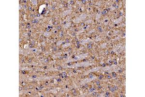 IHC analysis of Gephyrin/GPHN using anti-Gephyrin/GPHN antibody (ABIN7600086).