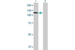 Western Blot analysis of SLC4A1 expression in transfected 293T cell line by SLC4A1 MaxPab polyclonal antibody. (Band 3/AE1 antibody  (AA 1-911))