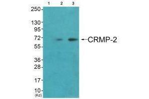 Western blot analysis of extracts from HuvEc cells (Lane 2) and JK cells (Lane 3), using CRMP-2 (Ab-522) antiobdy. (DPYSL2 antibody  (C-Term))