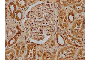 IHC image of ABIN7156223 diluted at 1:100 and staining in paraffin-embedded human kidney tissue performed on a Leica BondTM system. (IVNS1ABP antibody  (AA 401-642))