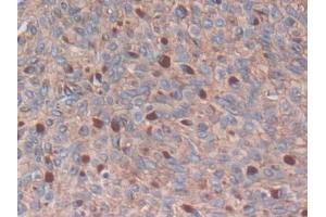 #VALUE! (S100A14 antibody  (AA 1-91))