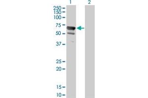 Western Blot analysis of NT5C2 expression in transfected 293T cell line by NT5C2 monoclonal antibody (M02), clone 3C1. (NT5C2 antibody  (AA 1-561))