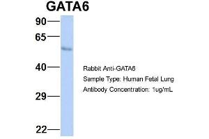 Host:  Rabbit  Target Name:  GATA6  Sample Type:  Human Fetal Lung  Antibody Dilution:  1. (GATA6 antibody  (N-Term))