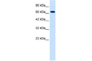 WB Suggested Anti-SCNN1B Antibody Titration:  0.