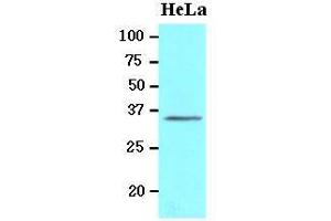 Western Blotting (WB) image for anti-BRCA1/BRCA2-Containing Complex, Subunit 3 (BRCC3) (AA 1-316), (N-Term) antibody (ABIN400864) (BRCC3 antibody  (N-Term))