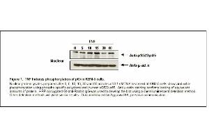 Image no. 1 for anti-Nuclear Factor-kB p65 (NFkBP65) (pSer529) antibody (ABIN116929) (NF-kB p65 antibody  (pSer529))