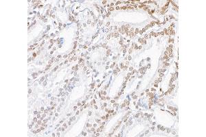 Immunohistochemistry (IHC) image for anti-Zinc Finger E-Box Binding Homeobox 2 (ZEB2) (AA 1164-1214) antibody (ABIN7453993)