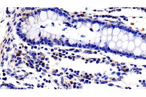 Detection of IL2Ra in Porcine Colon Tissue using Polyclonal Antibody to Interleukin 2 Receptor Alpha (IL2Ra) (CD25 antibody  (AA 22-245))