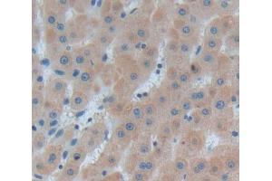 Used in DAB staining on fromalin fixed paraffin- embedded Kidney tissue (LMAN1 antibody  (AA 198-475))