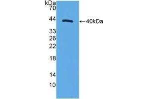 Detection of Recombinant MRP1, Human using Polyclonal Antibody to Motility Related Protein (MRP1) (CD9 antibody  (AA 112-195))