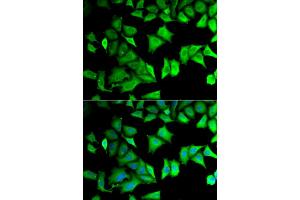 Immunofluorescence analysis of MCF-7 cells using RPS12 antibody (ABIN5973491). (RPS12 antibody)