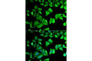 Immunofluorescence analysis of MCF-7 cells using RPS12 antibody (ABIN5973491).