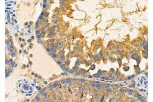 ABIN6263383 and ABIN6267002 at 1/100 staining Rat testis tissue by IHC-P.