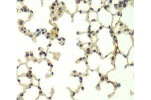 Immunohistochemistry of paraffin-embedded Mouse lung using FBXW11 Polyclonal Antibody at dilution of 1:100 (40x lens). (FBXW11 antibody)