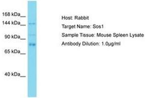 Image no. 1 for anti-Son of Sevenless Homolog 1 (SOS1) (AA 353-402) antibody (ABIN6750497) (SOS1 antibody  (AA 353-402))