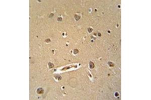 Formalin fixed, paraffin embedded human brain tissue stained with MGC24039 Antibody (C-term)  followed by peroxidase conjugation of the secondary antibody and DAB staining. (MGC24039 (AA 1073-1102), (C-Term) antibody)