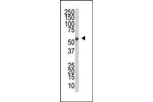 Western blot analysis of anti-SRPK2 Pab in mouse thymus tissue lysate. (SRPK2 antibody  (C-Term))