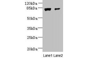 Western blot All lanes: WDR49 antibody at 7 μg/mL Lane 1: A549 whole cell lysate Lane 2: Hela whole cell lysate Secondary Goat polyclonal to rabbit IgG at 1/10000 dilution Predicted band size: 80, 60 kDa Observed band size: 80 kDa (WDR49 antibody  (AA 251-500))