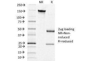 SDS-PAGE Analysis of Purified, BSA-Free hCG Receptor Antibody (clone LHCGR/1415).