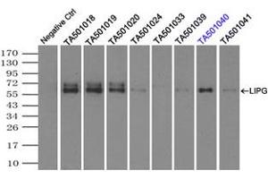 Image no. 2 for anti-Lipase, Endothelial (LIPG) antibody (ABIN1499162)