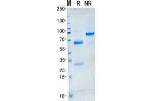 Validation with Western Blot (IL23A Protein)