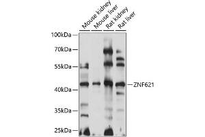 Western blot analysis of extracts of various cell lines, using ZNF621 antibody  at 1:1000 dilution. (ZNF621 antibody  (AA 60-150))