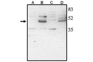 Image no. 1 for anti-Visual System Homeobox 2 (VSX2) (AA 264-361), (C-Term) antibody (ABIN265010) (VSX2 antibody  (C-Term))