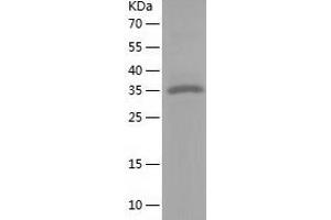 Western Blotting (WB) image for Reticulocalbin 3, EF-Hand Calcium Binding Domain (RCN3) (AA 21-328) protein (His tag) (ABIN7288295) (RCN3 Protein (AA 21-328) (His tag))