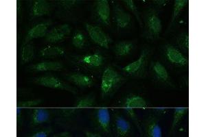 Immunofluorescence analysis of U-2 OS cells using AEBP1 Polyclonal Antibody at dilution of 1:100 (40x lens). (AEBP1 antibody)