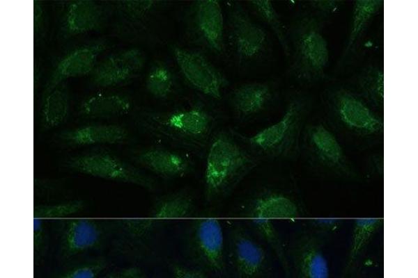 AEBP1 antibody