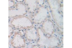 IHC-P analysis of Human Tissue, with DAB staining. (CUBN antibody  (AA 3157-3274))