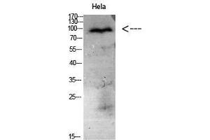 Western Blot (WB) analysis of HeLa cells using Antibody diluted at 1:1000. (CD56 antibody)