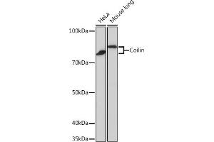Western blot analysis of extracts of various cell lines, using Coilin Rabbit mAb (ABIN7266451) at 1:1000 dilution.