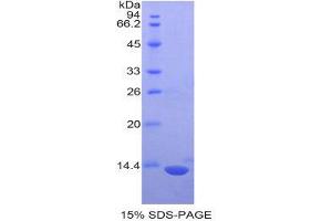 SDS-PAGE (SDS) image for S100 Protein (S100) (AA 2-94) protein (His tag) (ABIN1877707)