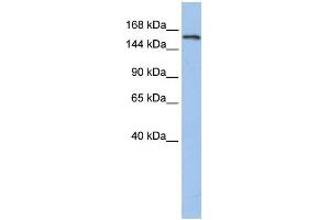 WB Suggested Anti-UBE3A  Antibody Titration: 0. (ube3a antibody  (N-Term))
