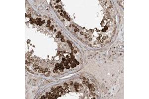 Immunohistochemical staining (Formalin-fixed paraffin-embedded sections) of human testis with CETN3 polyclonal antibody  shows cytoplasmic and nucleolar positivity in cells in seminiferous ducts.